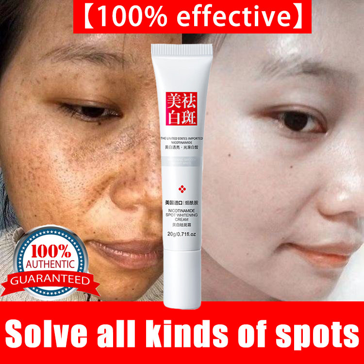 Authentic Melasma Remover Cream Melasma and pekas remover original Dark spot remover freckle