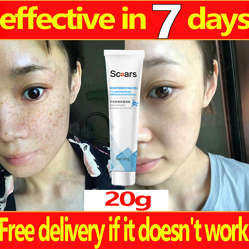 【Doctor Scar Remover Gel 60 g Serum Cream Scars Repair