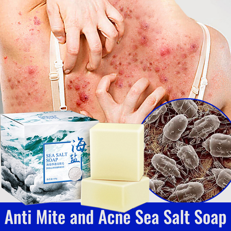 Sea Salt Soap Whitening Soap Removal Pimple Pores Acne Treatment