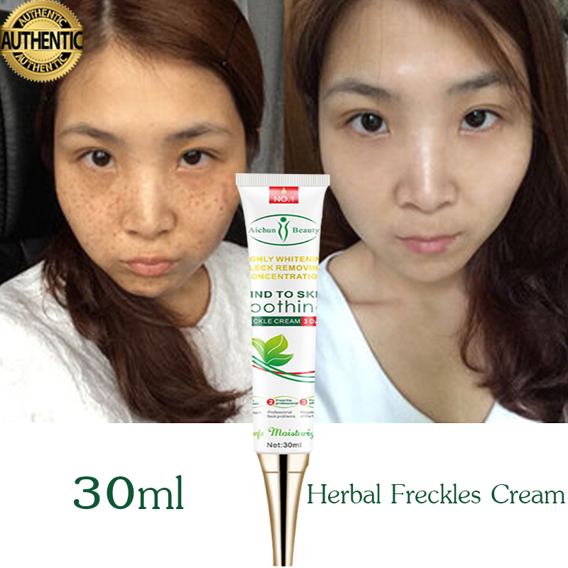 miracle cream for melasma