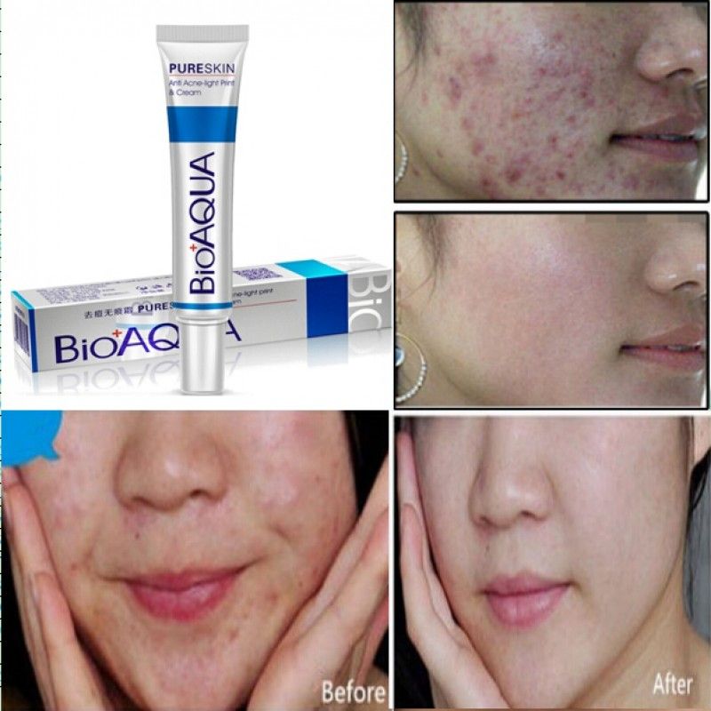 bioaqua before and after
