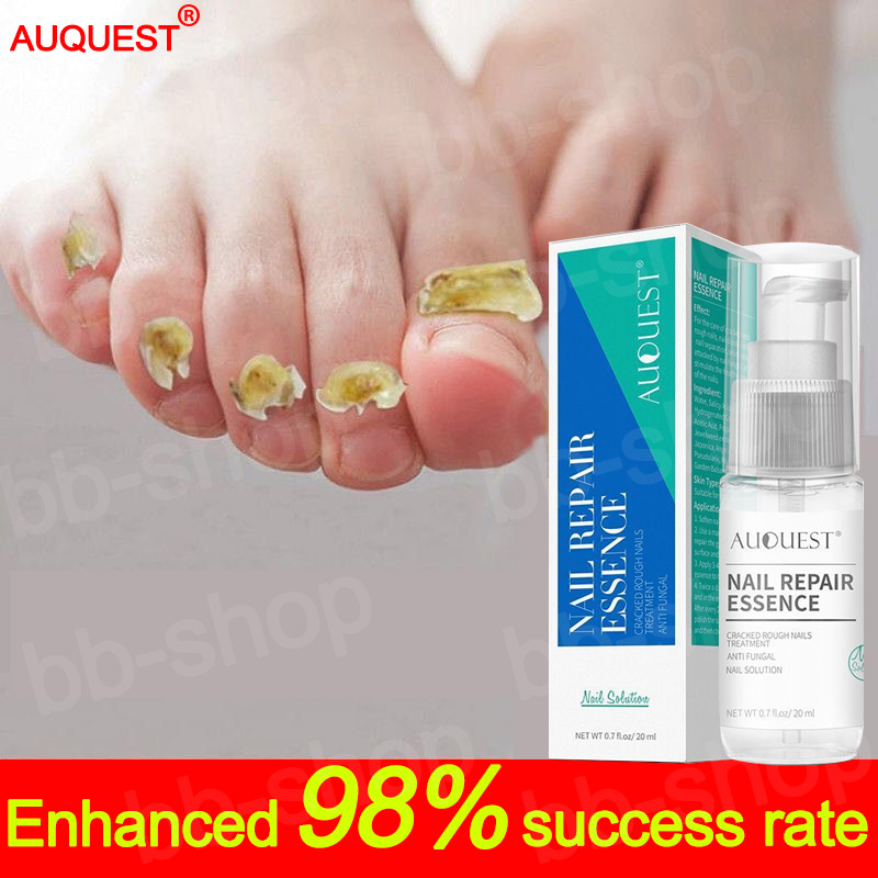 Painless fungla nail infection repair AUQUEST Nail Repair Essence，Nail
