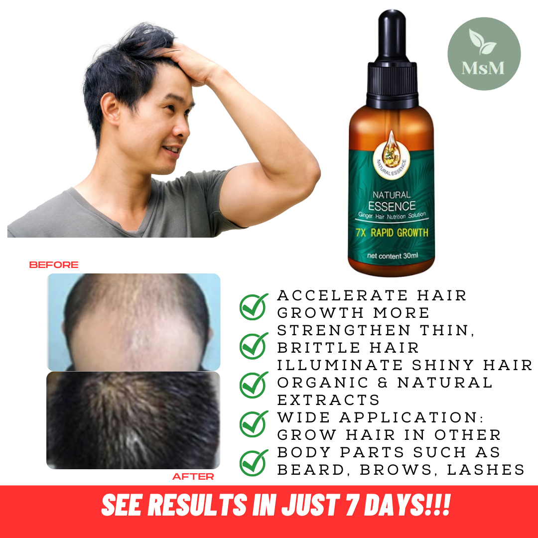 MsM HAIR SERUM ESSENCE Hair Treatments Ginger Oil Hair Grower for Men ...