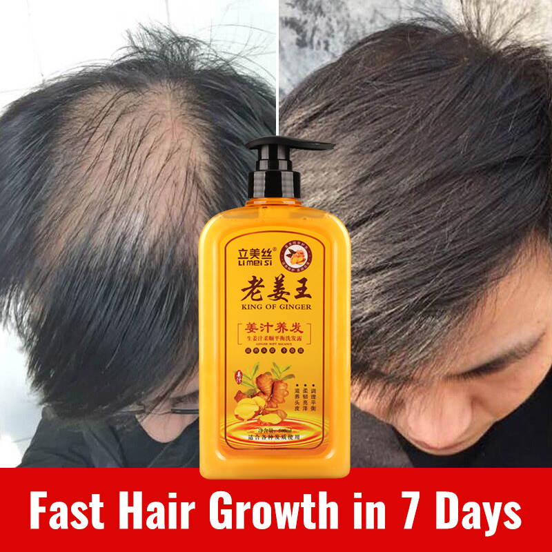 100 Effective Original Ginger Shampoo Fast Powerful Hair Growth Liquid Anti Hair Loss Shampoo 5973