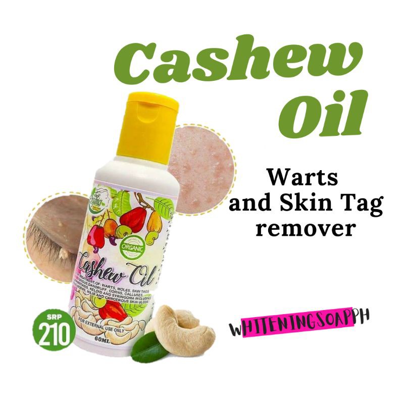 CASHEW OIL / Kasoy Oil / Warts Remover Original / Casoy Oil / Herbal