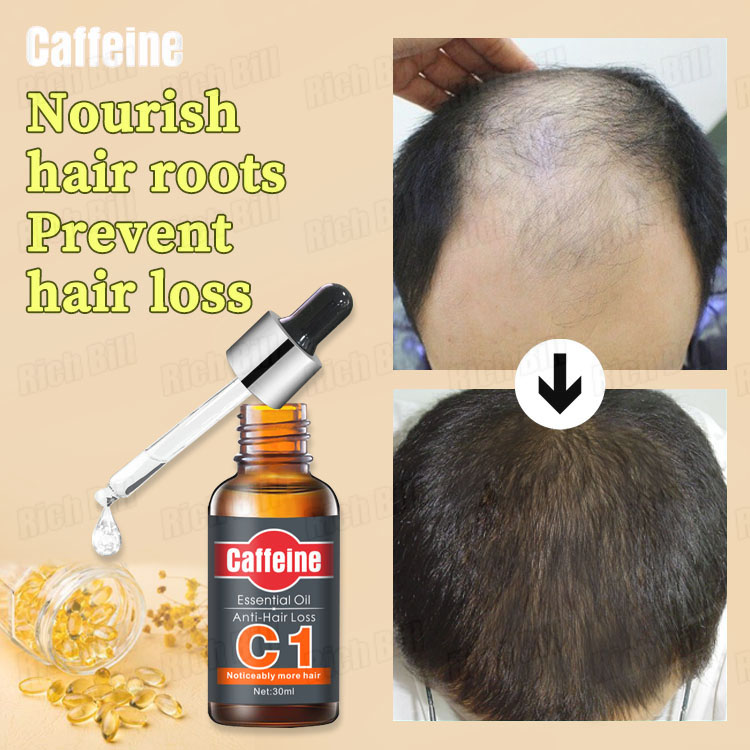 CAFFEINE Hair Growth Essential Oil Hair Loss Treatment Hair Grower Vitamin  E Hair Care Effectively Stimulates Rapid Hair Growth Prevents Hair Loss  Strengthens Hair And Men And Women With Thick Hair (30ml) |