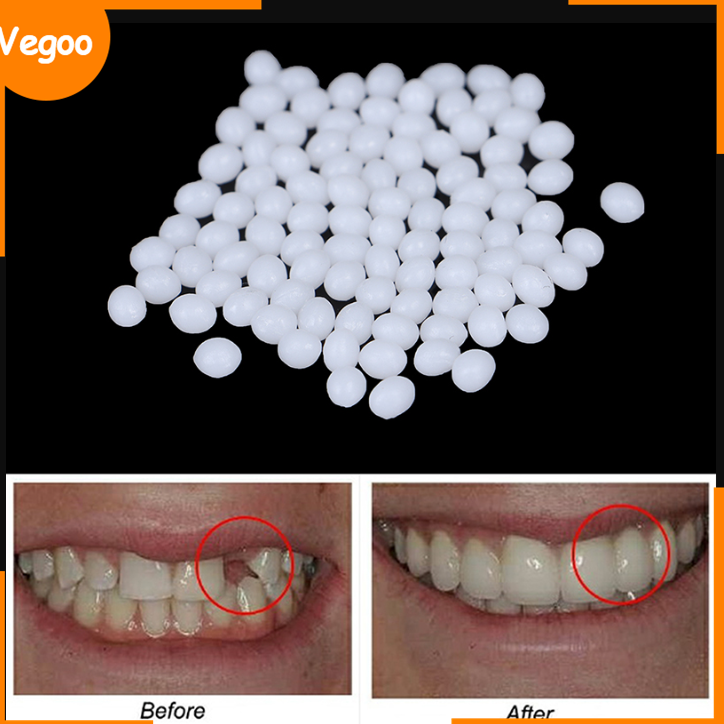 10g/100g Teeth And Gap Falseteeth Solid Glue Resin Denture Adhesive Teeth  Dentist Falseteeth Solid Glue Temporary Tooth