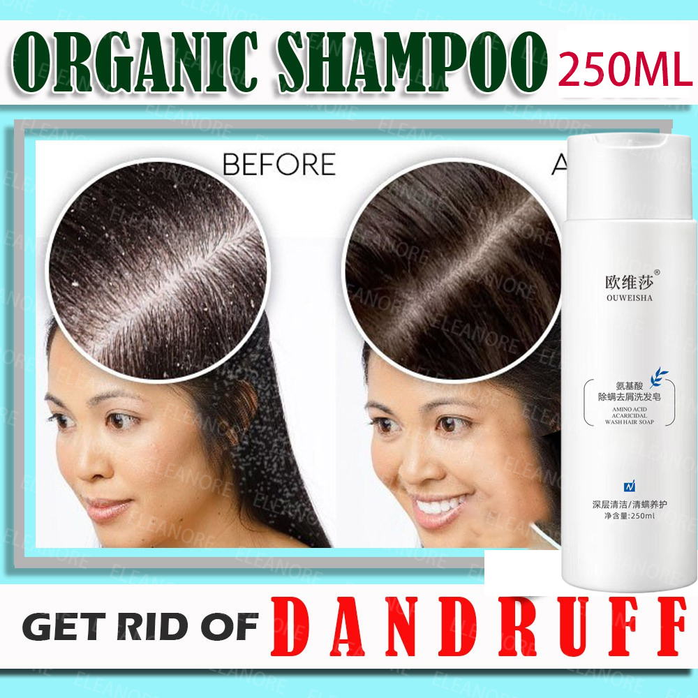 Anti Dandruff Shampoo Fast Effective Anti Dandruff Scalp Treatment Itching Flaking Scalp