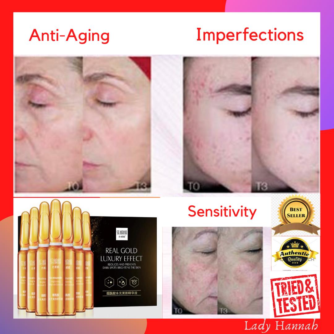 niacinamide for dark spots