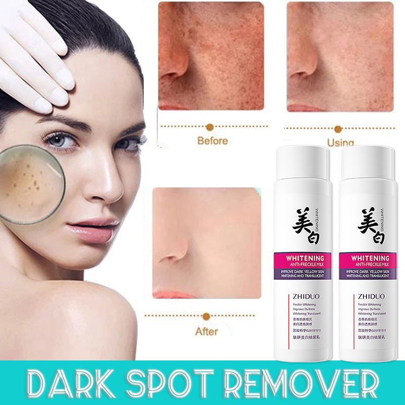 Effective Freckle Removal Whitening Cream Melasma Removal Cream Anti Melasma And Dark Spots