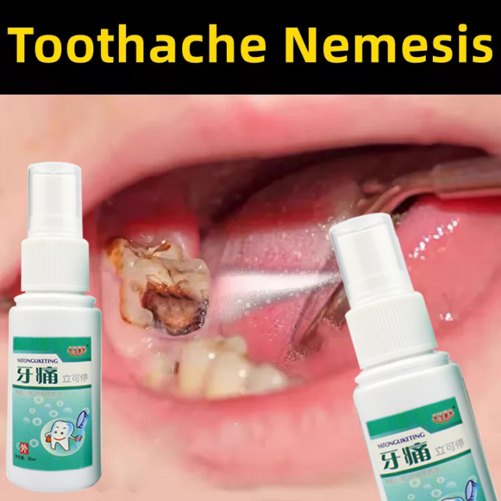 Toothache Spray 35ml Fast Pain Relief Plant Extracts Hormone Free Wisdom Tooth Removal Toothache