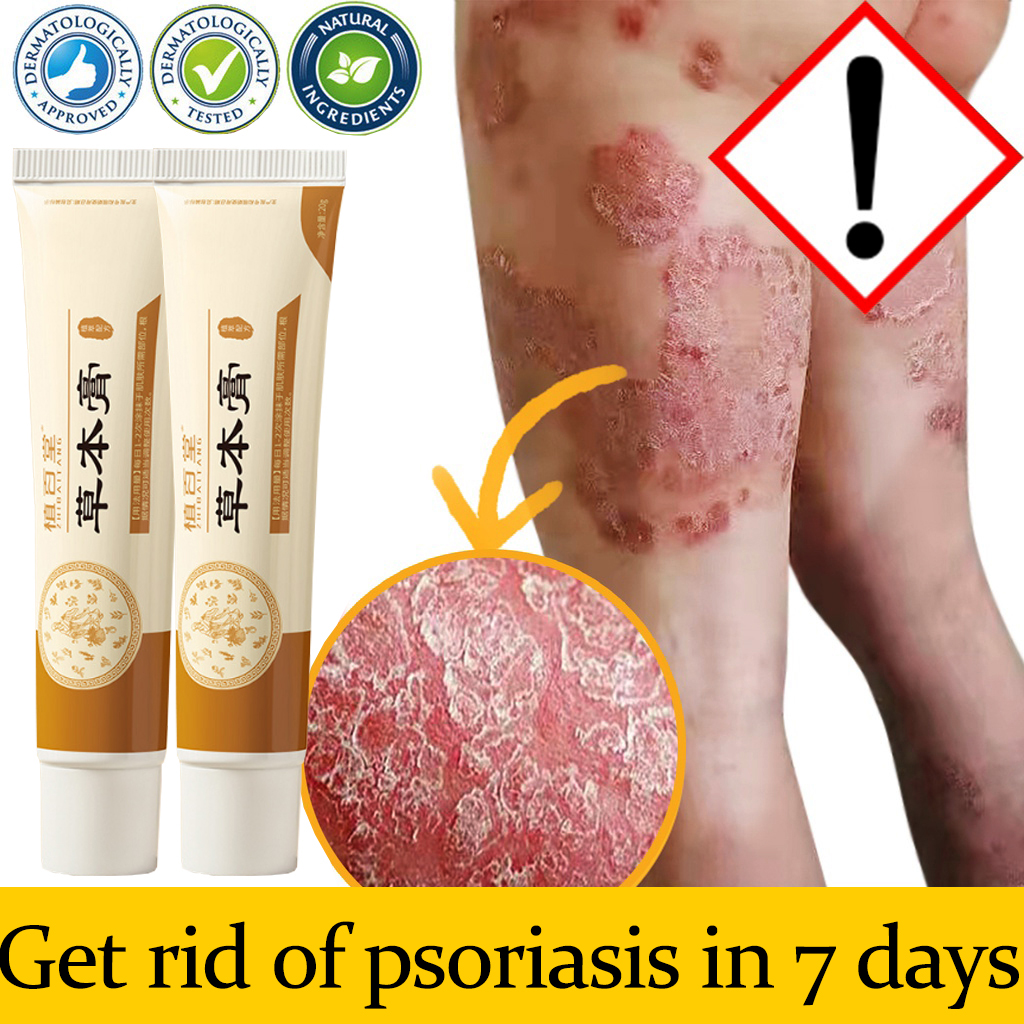 【Price per bottle ₱79】Skin disease ointment Skin Fighter Cream 20g