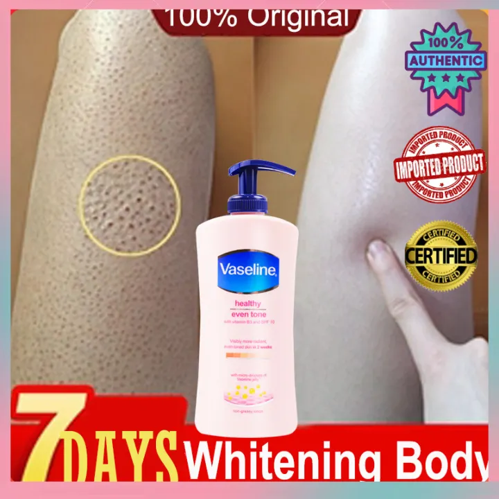 moisturizing and whitening lotion
