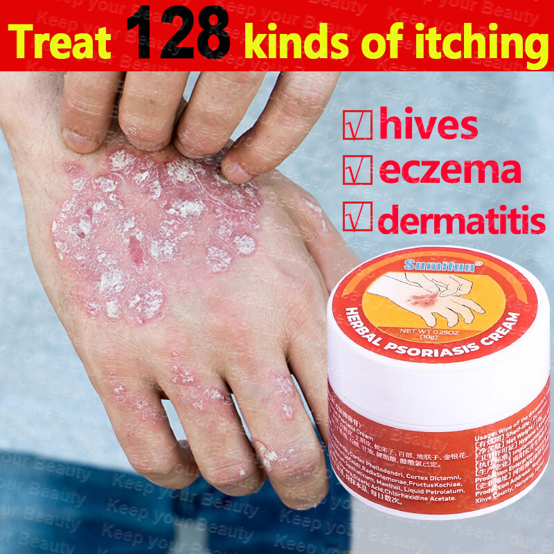 Sumifun Eczema Treatment Cream 20g Psoriasis Treatment Cream Quickly
