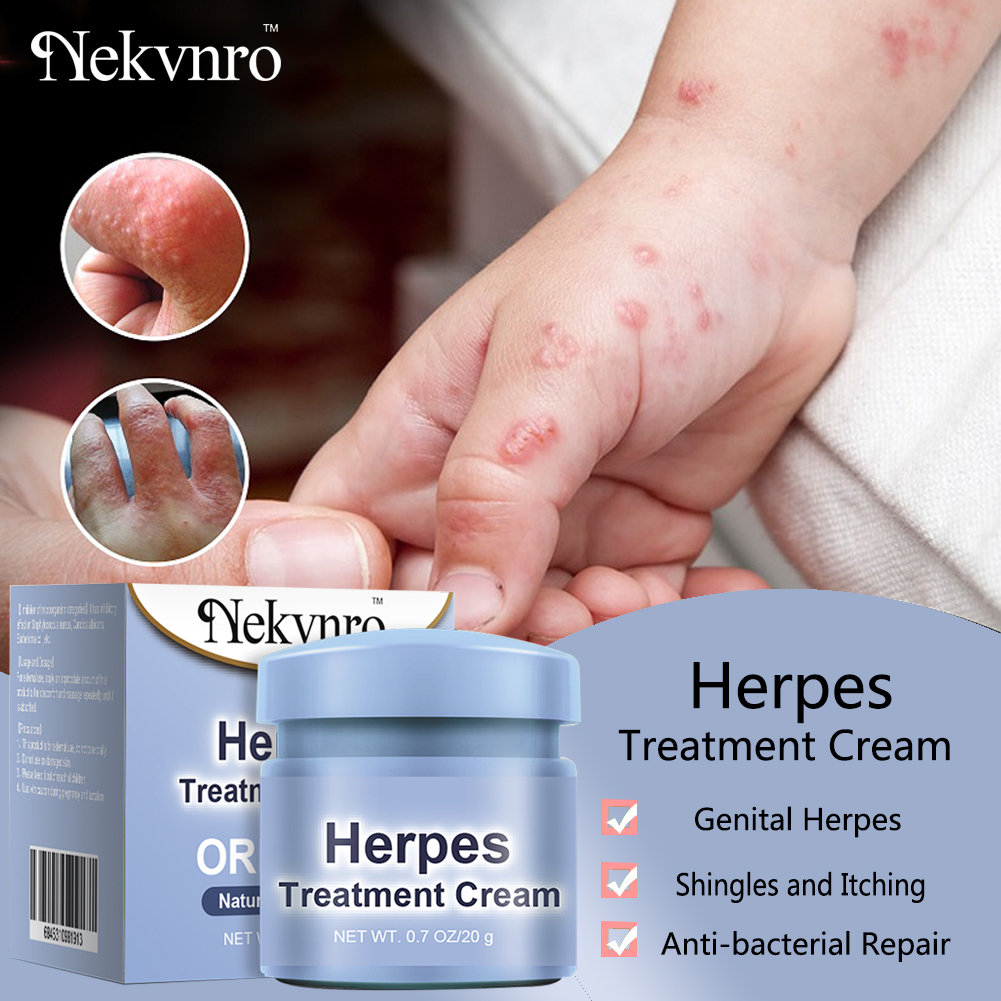 Genital Herpes Treatment