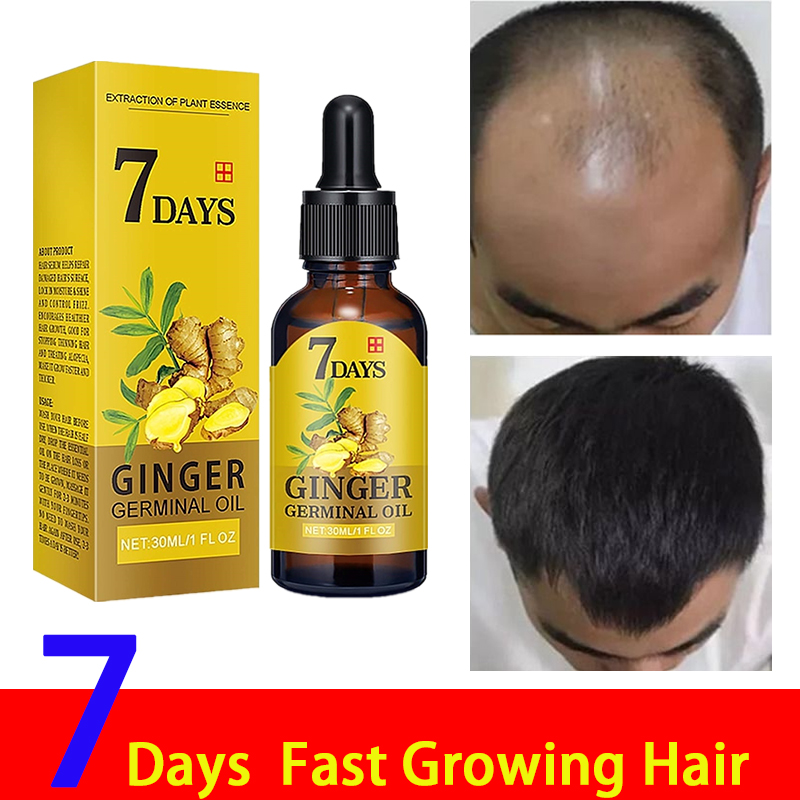 3 Pack Ginger Germinal Oil Hair Growth Serum Essential Loss Treatment