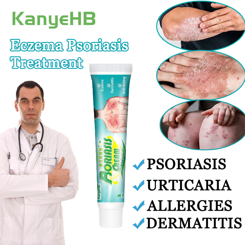 KanyeHB Psoriasis cream eczema ointment Scalp Hand Tinea Foot Tinea