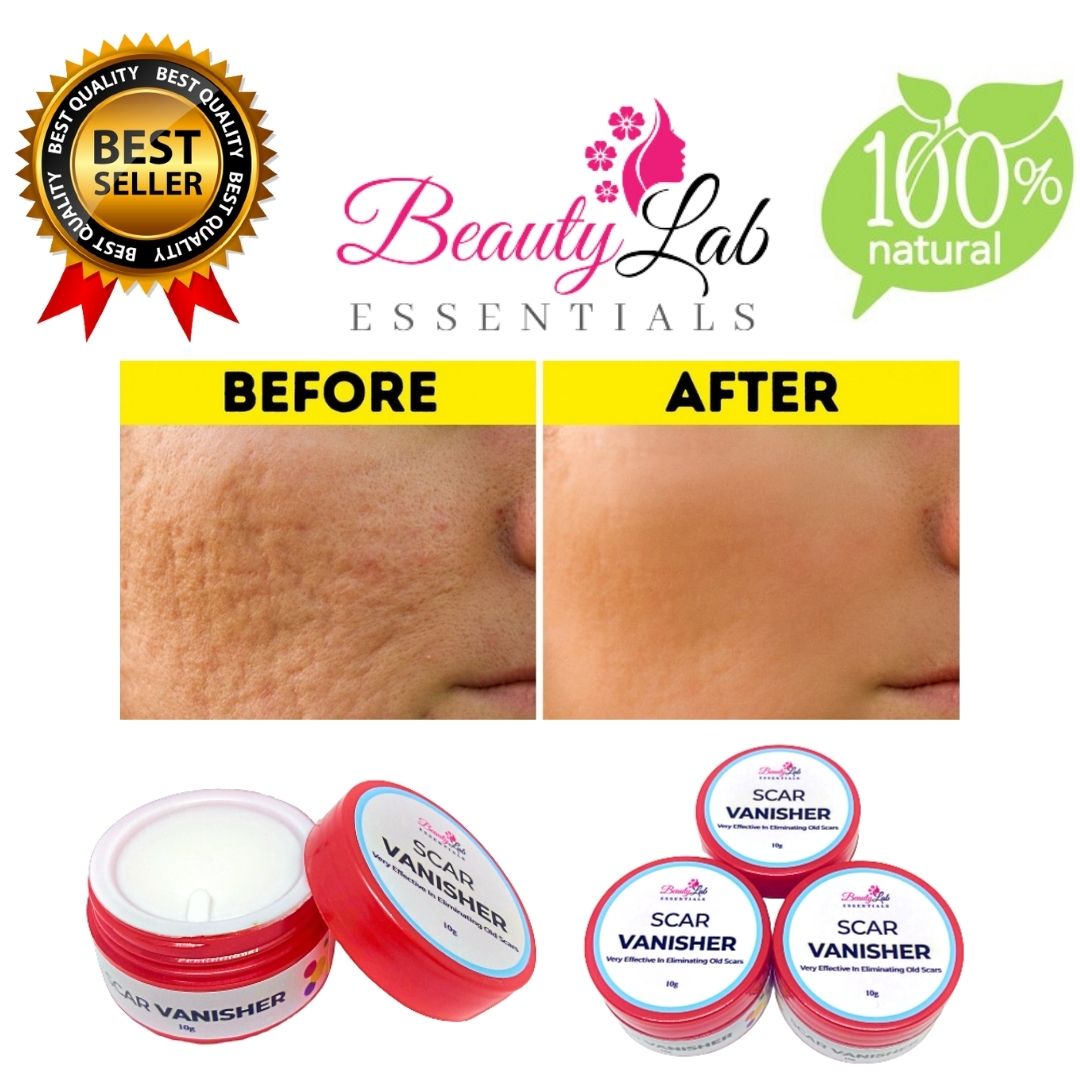 GO2GO SHOP Beauty Essentials Scar Removal Cream (10g) Beauty