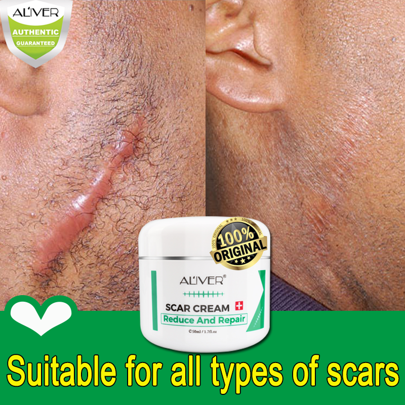 Keloid Scar Remover for Old Scar on Leg Scars Remover for Old Scars