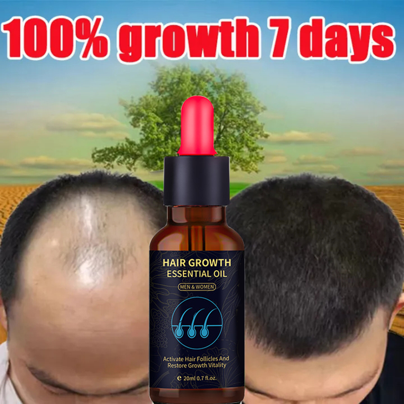 Yanjiayi Minoxidil 5 Hair Growth Essential Oil Ginger Hair Nutrient