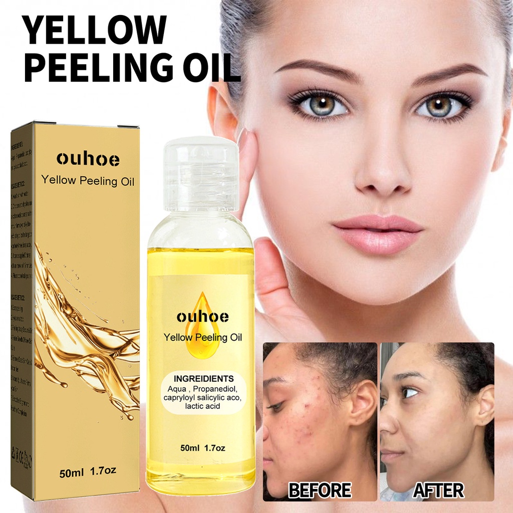 Yellow Peeling Oil Pimple Eraser Scarminator Skin Peeling Body Peeling