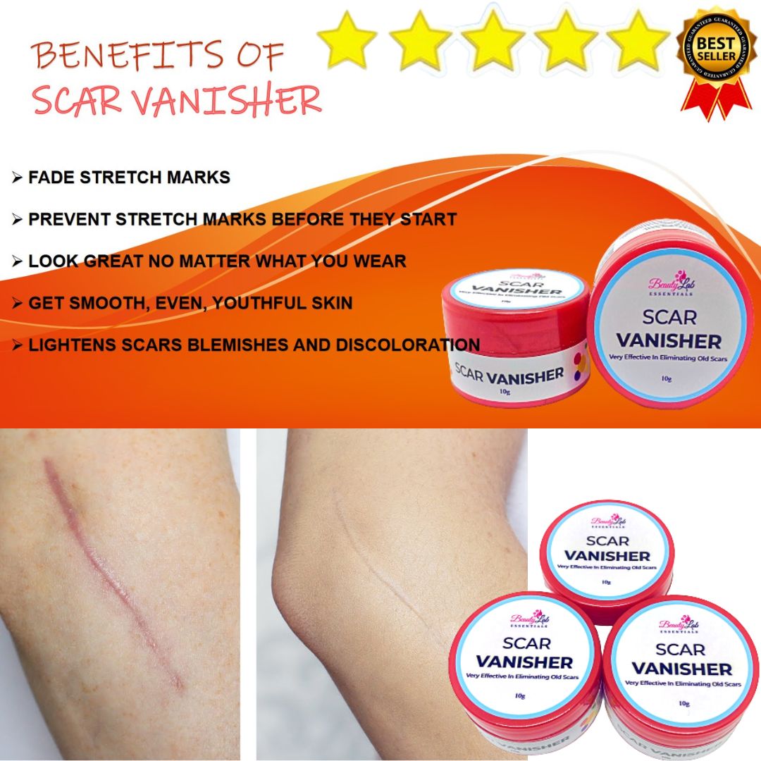 beauty-lab-essentials-scar-vanisher-10g-for-old-scars-pang-tanggal-ng