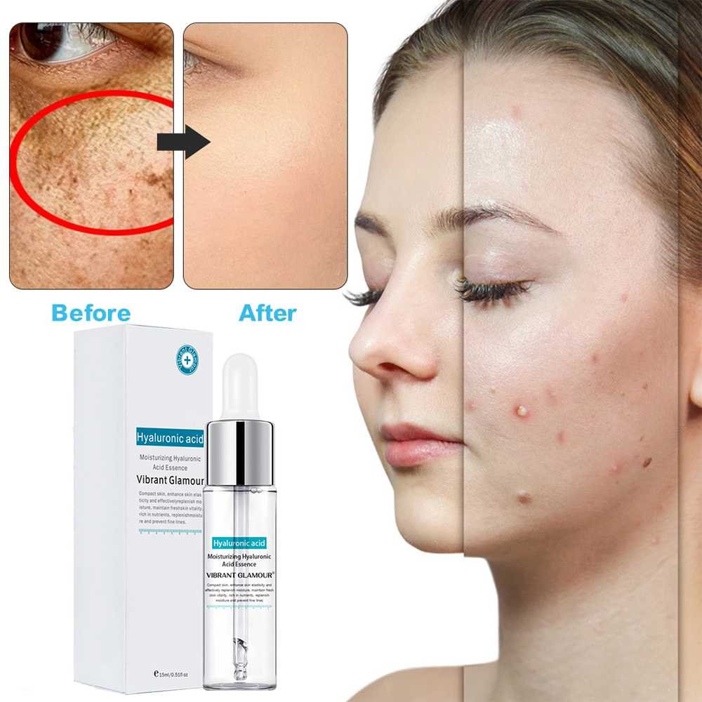 Local delivery VIBRANT GLAMOUR Hyaluronic Bleaching Facial Serum