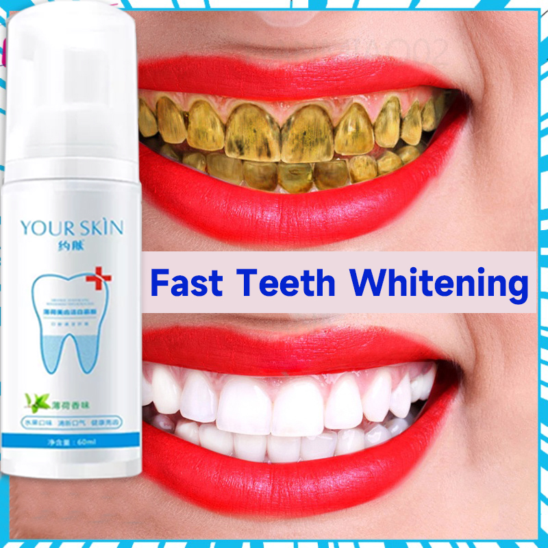 Teeth Whitening Serum Gel Dental Oral Hygiene Effective Remove Stains