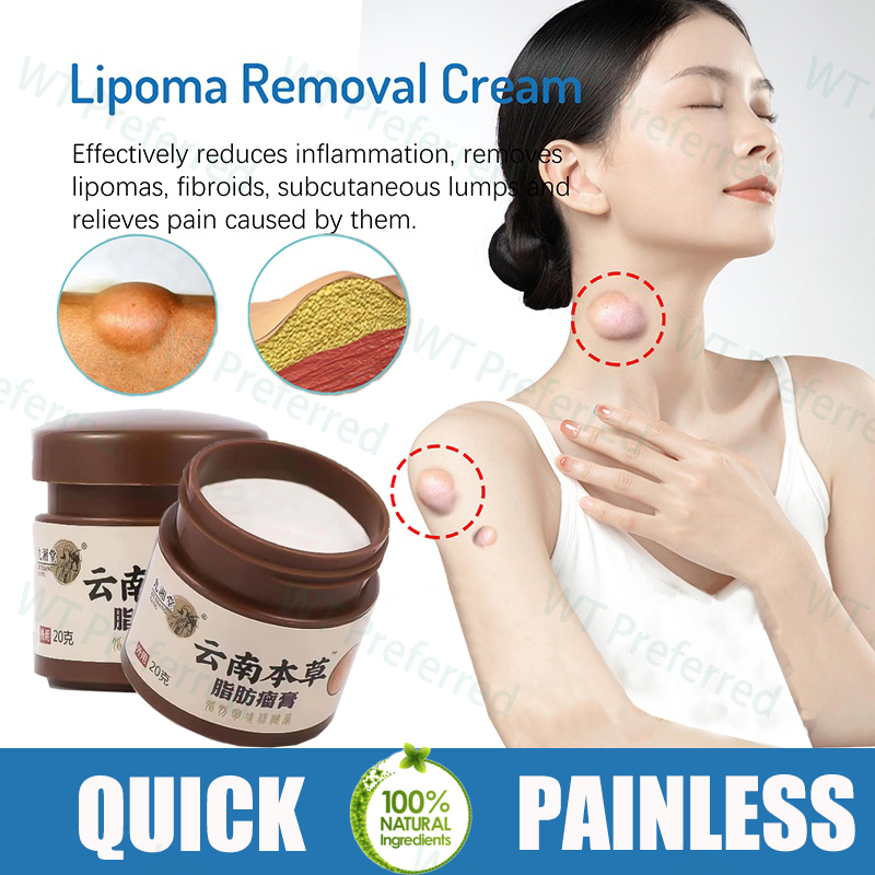 Lipoma removal cream original treat tumor skin swelling ointment herbal ...