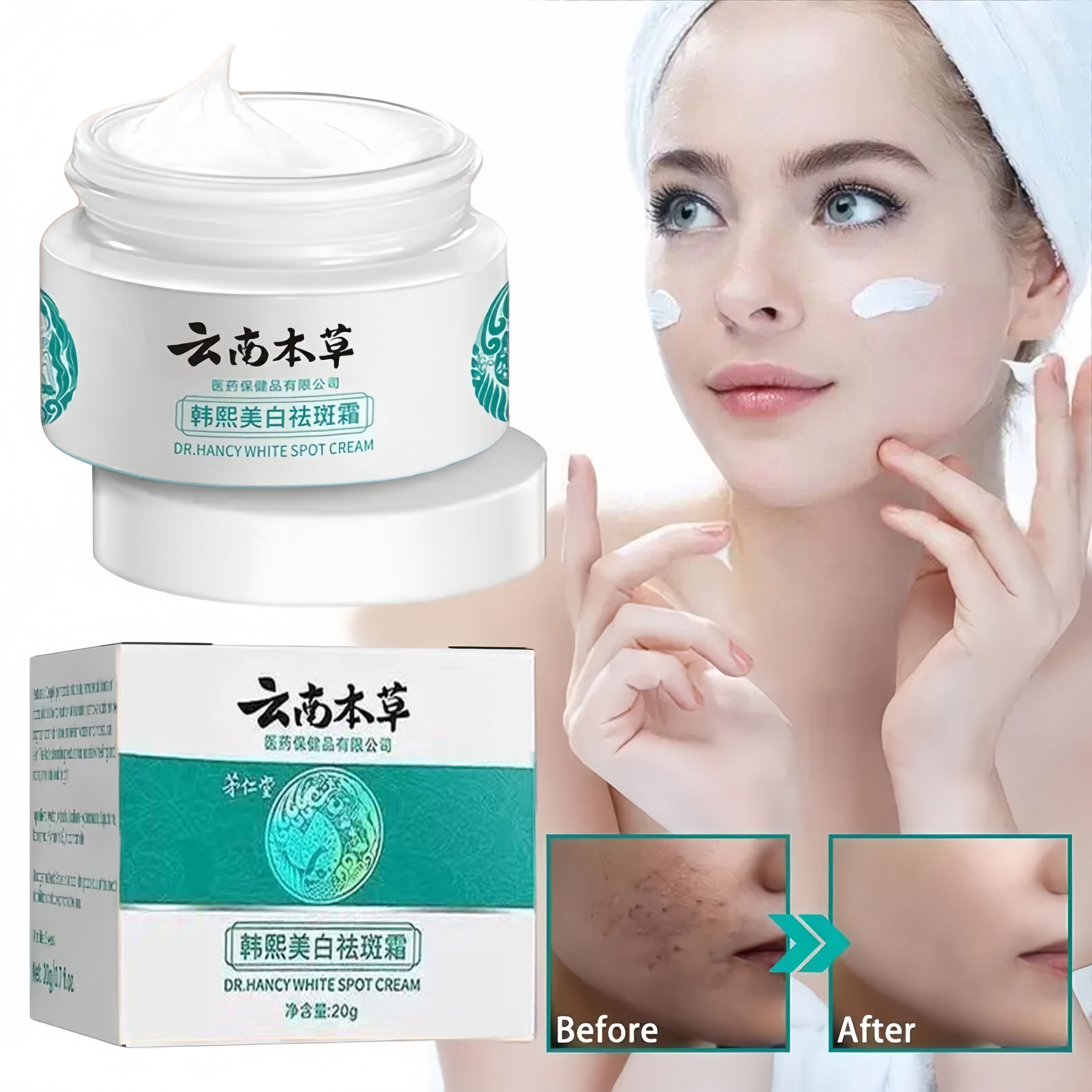 Hanxi Whitening and Freckle Cream Herbal Melasma Cream White Spot Cream ...