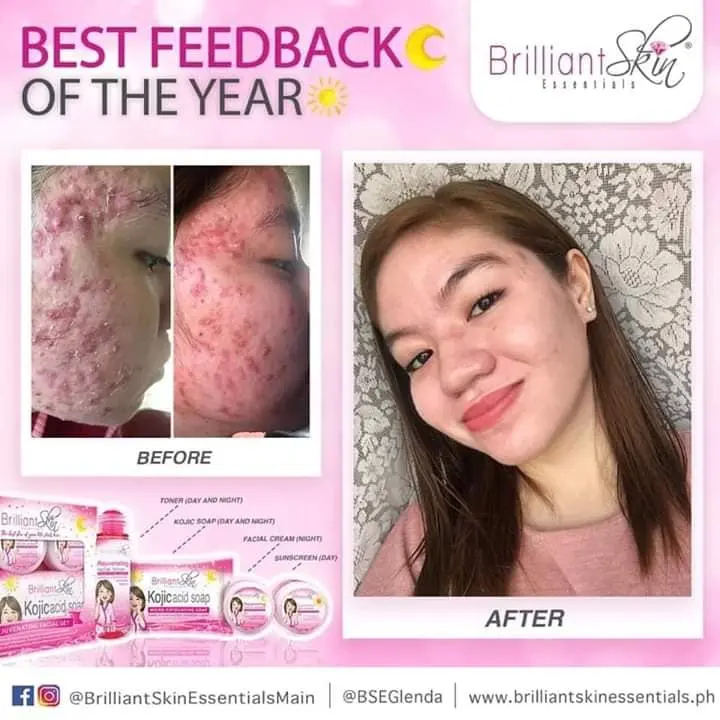 brilliant skin