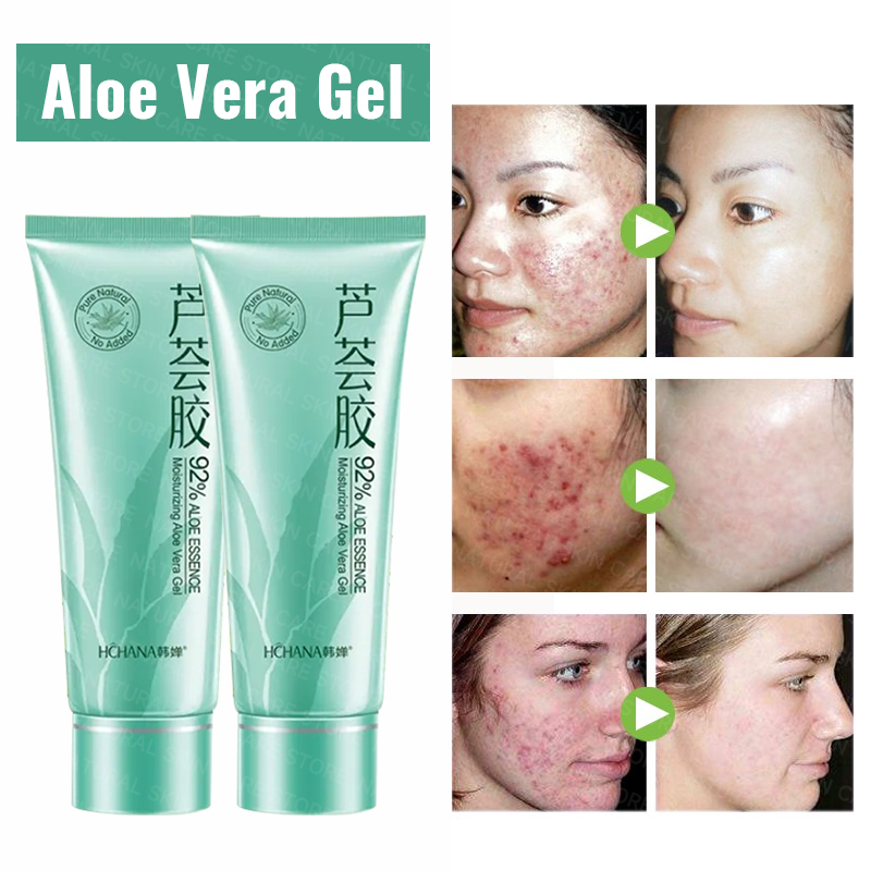 Acne Aloe Vera Gel Aloe vera gel with collagen Removes Facial Acne ...