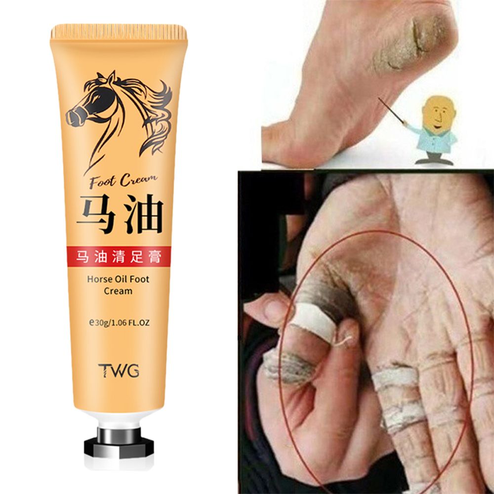 TWG Foot Cream Horse Oil Foot Cream 30g Feet Cream Effectively Exfoliating And Whitening Heel