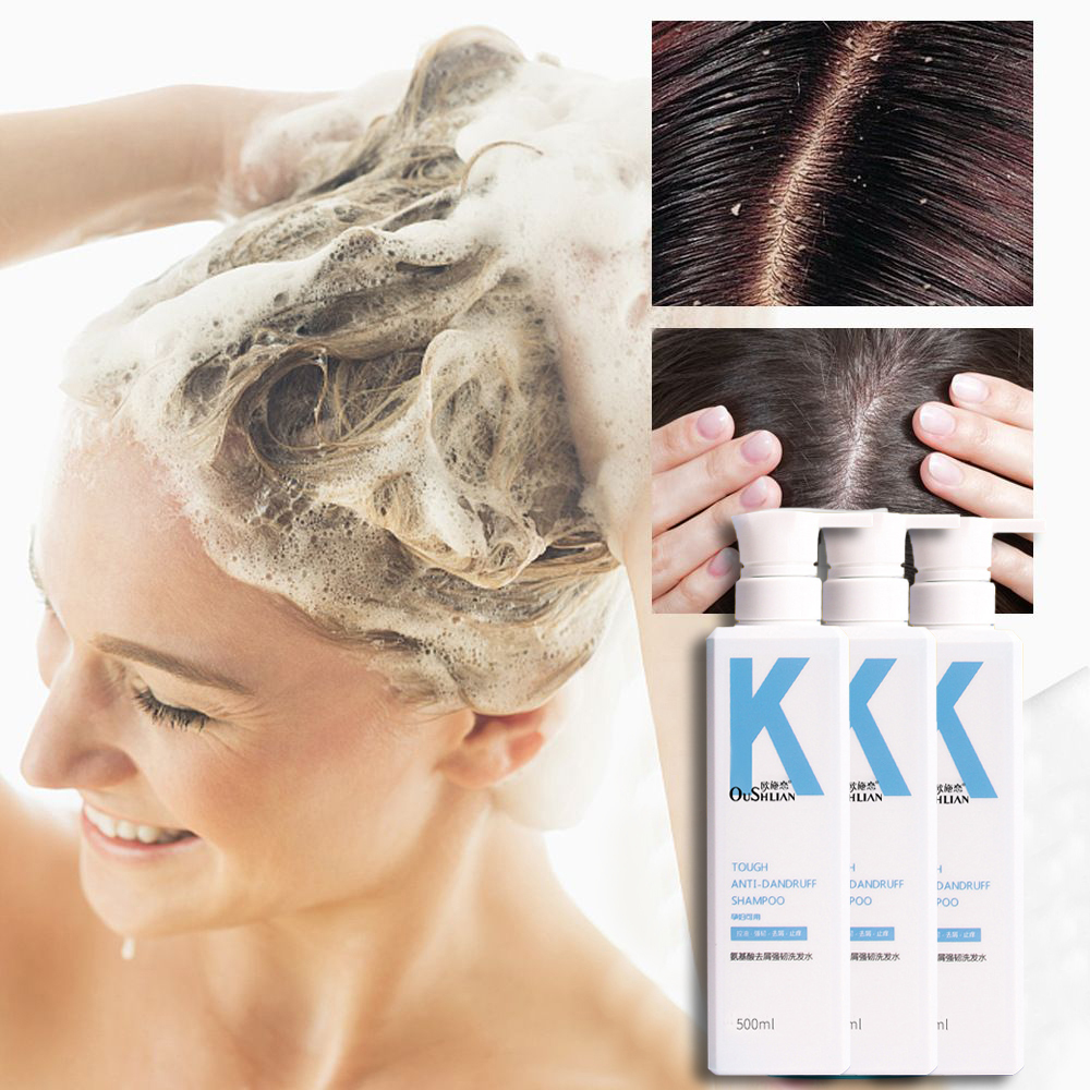 500ml KONO AntiFungal Shampoo new formula to solve hair problems Anti