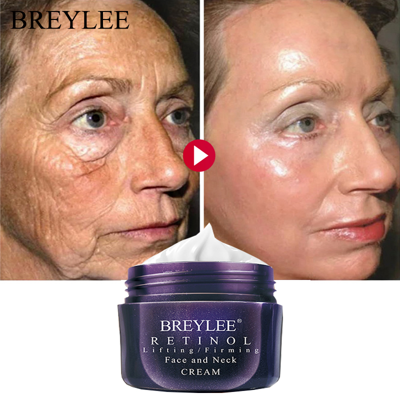 anti wrinkle cream with retinol
