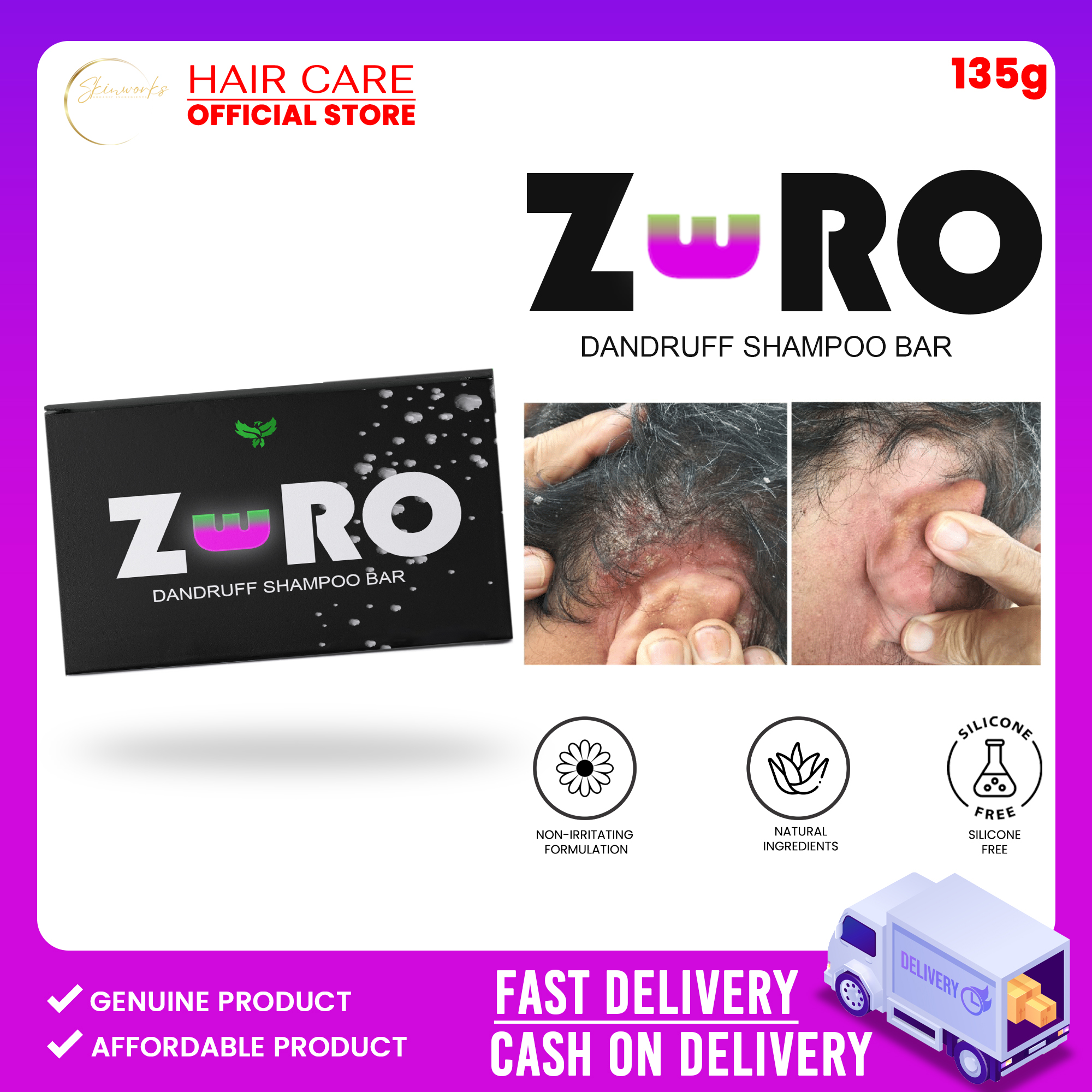 DANDRUFF REMOVER【ZERO Shampoo Bar】 dandruff scalp treatment , dandruff