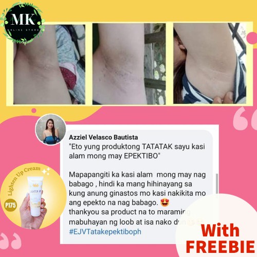 MK Lighten Up Cream/ AntiChicken Skin/Underarm Whitening Cream/COD