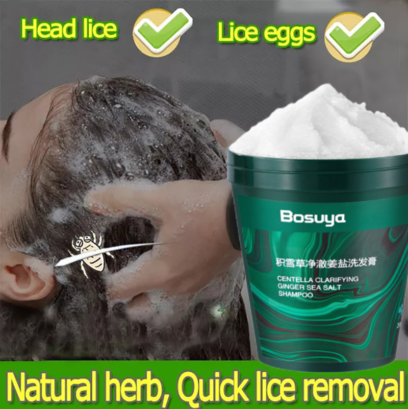 【Quick results in 5 minutes】lice removal shampoo for kids free shower cap grate comb anti lice