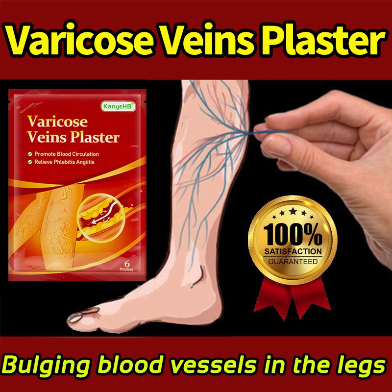 Varicose Ointment veins Treatment Bandages pain relievers patch relief
