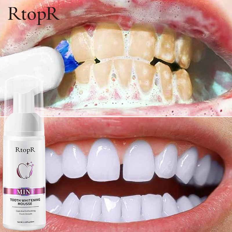 Rtopr Teeth Oral Hygiene Essence Whitening Essence Daily Use Effective