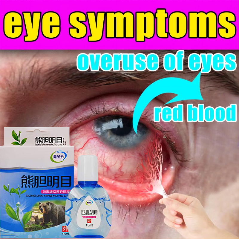 【3 Seconds Restore you vision】Original Japan Eyedrops 15ml for