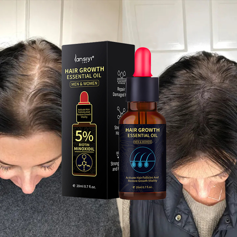 Minoxidil 5 Hair Grower Serum Original Hair Growth Minoxidil Hair