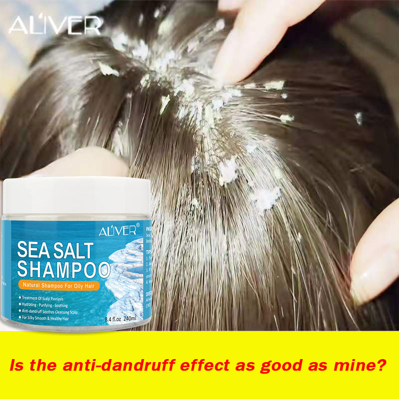 ALIVER Sea Salt Shampoo Anti Dandruff Shampoo 200g For Scalp Psoriasis  Itching Scalp And Dandruff - For Men & Women Anti Hair Loss Nourish Hair  Fast Growth Removal Anti Dandruff & Scalp
