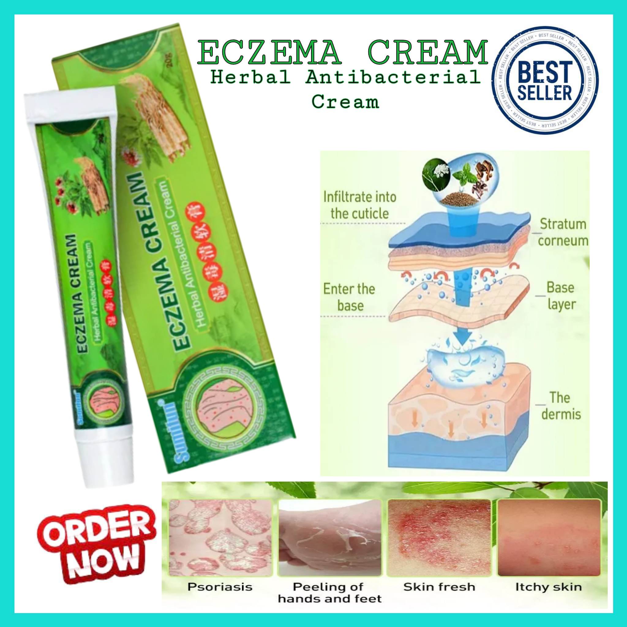 Best Selling! Sumifun Eczema Treatment Cream gamot sa kati kati sa ...