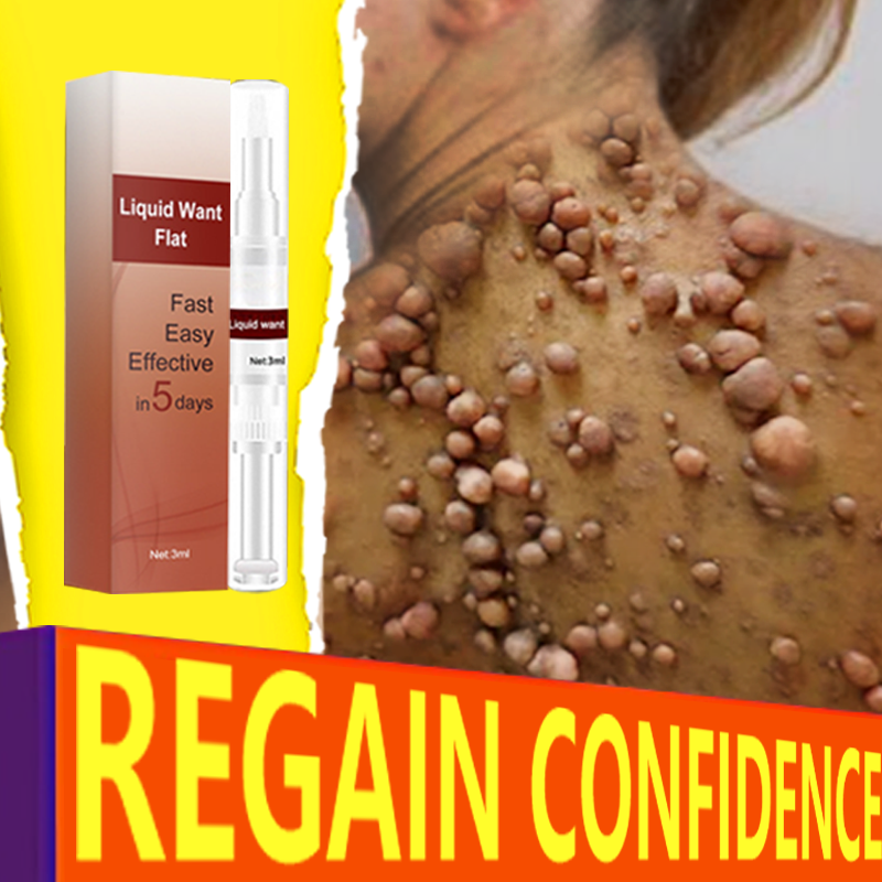The nasty warts are gone ★ Regain confidence ★ Dare to wear bikini