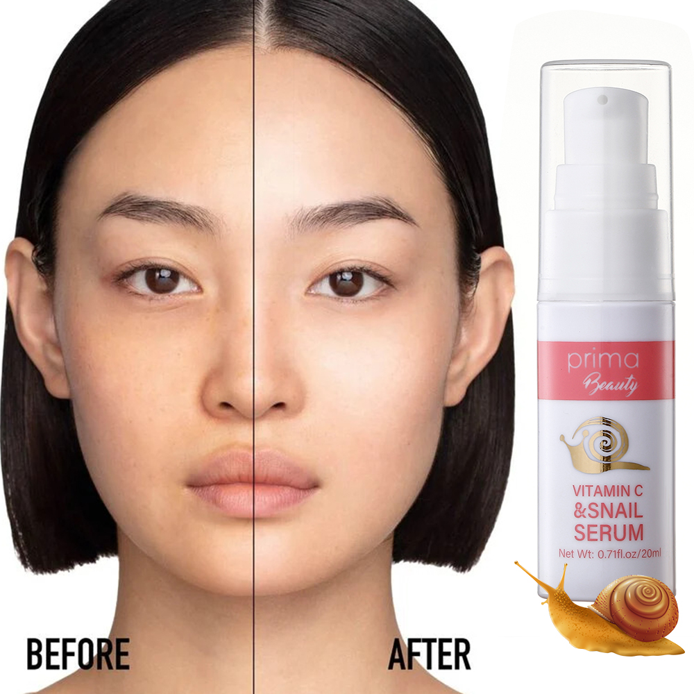 prima-korean-whitening-serum-w-vitamin-c-and-snail-filiate-for