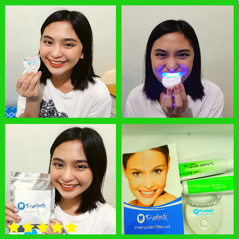 Whitelight Teeth Whitening Kit Review Shelly Lighting 