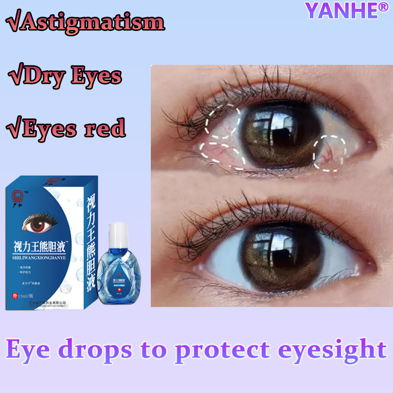 15ML original eye drops for cataract eyedrops for tired eyes Dry sore