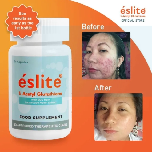 Eslite S-Acetyl Glutathione 60 Capsules