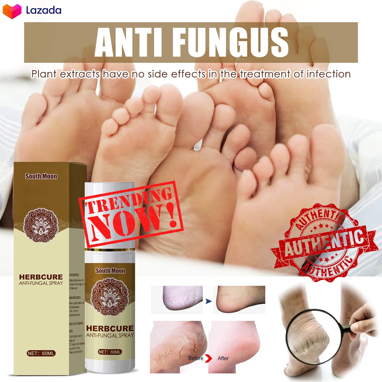 Sl Chang Natural Herbal Fungus Combat Feet Spray Anti Fungal Infections
